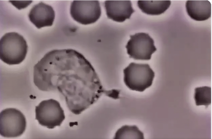 Fascinerende bilder: Hvit blodcelle fra menneske jager bakterie